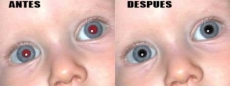 Aprende fácilmente a corregir los ojos rojos en tus fotos