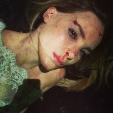 ¡Belinda tuvo un accidente!