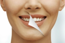 Blancorexia: obsesión por los dientes blancos.