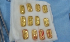 Cirujanos indios hallan 12 barras de oro en el estómago de un paciente
