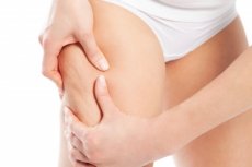 Cómo eliminar las estrías de tu cuerpo.
