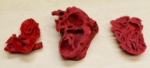 Corazón obtenido mediante impresión 3D logra salvar la vida de un niño en Estados Unidos