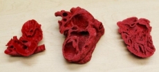 Corazón obtenido mediante impresión 3D logra salvar la vida de un niño en Estados Unidos