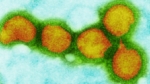 ¿Cuál es el virus más contagioso que ha existido?