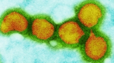 ¿Cuál es el virus más contagioso que ha existido?