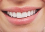 ¿Dientes perfectos? 10 trucos caseros para lograrlo