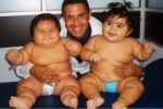 Estos bebés pesan 41 kilos entre los dos… Y están adelgazando juntos