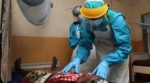Hallan una toxina que mata a 2.000 millones de personas en las heces de un niño botulínico