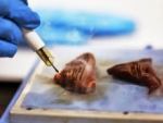 iKnife: Un bisturí inteligente que detecta tejidos cancerígenos.