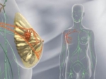Investigadores españoles hallan una proteína que frena el cáncer de mama.