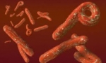 Las diez enfermedades contagiosas que causan más muertes (y no está el ébola)