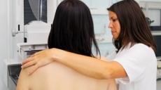 Los lunares podrían ayudar a predecir el riesgo de cáncer de mama