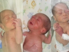 Menor de 13 años da a luz a trillizos en la Maternidad