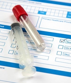 ¿Qué exámenes de enfermedades de transmisión sexual (ETS) debes hacerte?