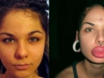 Rusa se ha operado 100 veces para tener labios más grande del mundo