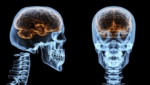 Según los científicos, dormir mal puede encoger tu cerebro