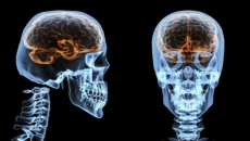 Según los científicos, dormir mal puede encoger tu cerebro
