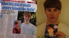 Un hombre de 33 años se operó la cara para parecerse a Justin Bieber