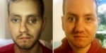Utilizan una impresora 3D para reconstruir la cara de un hombre
